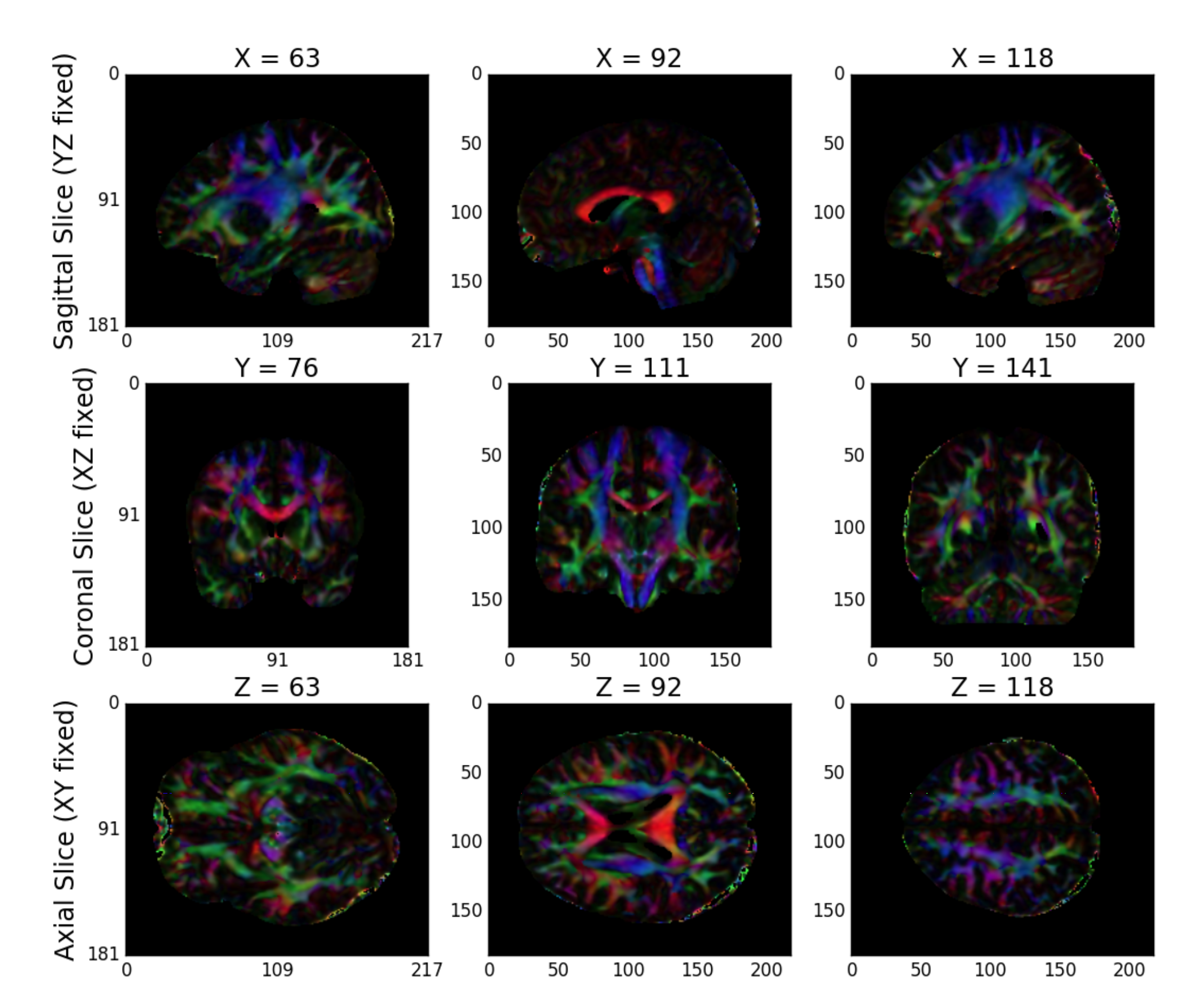 _images/tensor-qa.png